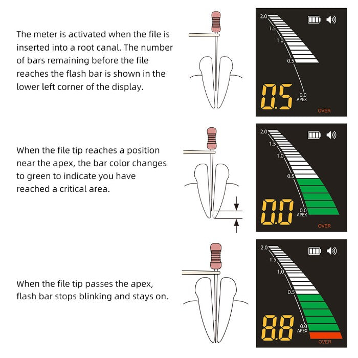 Dental Apex Locator Root Canal + Endo Motor LED Mini 16:1 Contra Angle