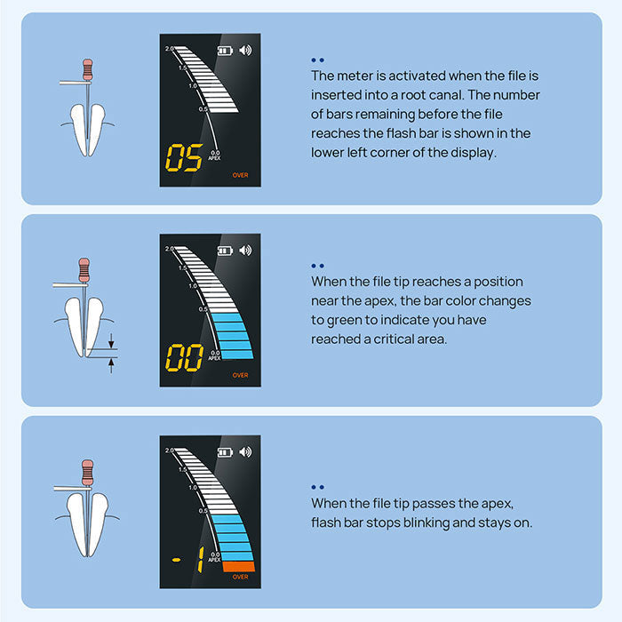 Dental Endo Apex Locator Root Canal Measurement Tool