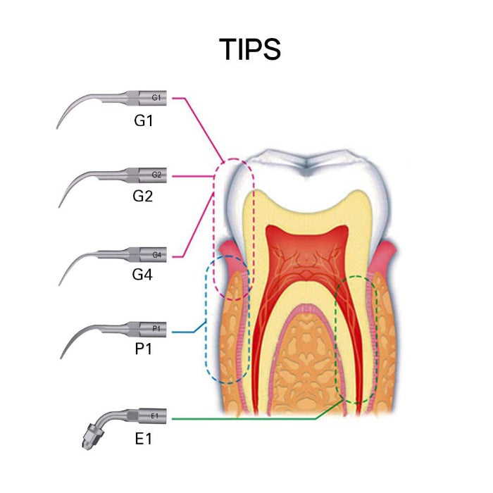 Dental Ultrasonic Scaler Wireless Control LED Handpiece 5 Tips