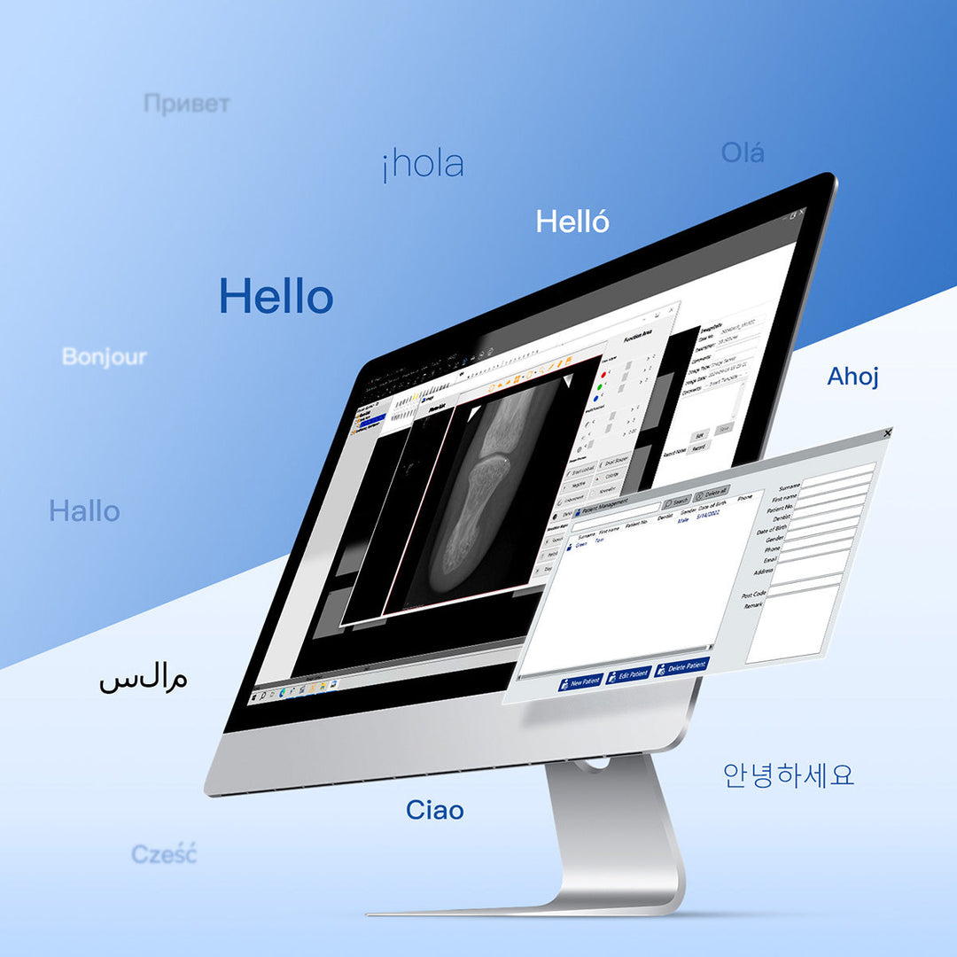 Dental Sensor X-Ray Digital Sensor Intraoral Digital System HD Image Size1/Size2