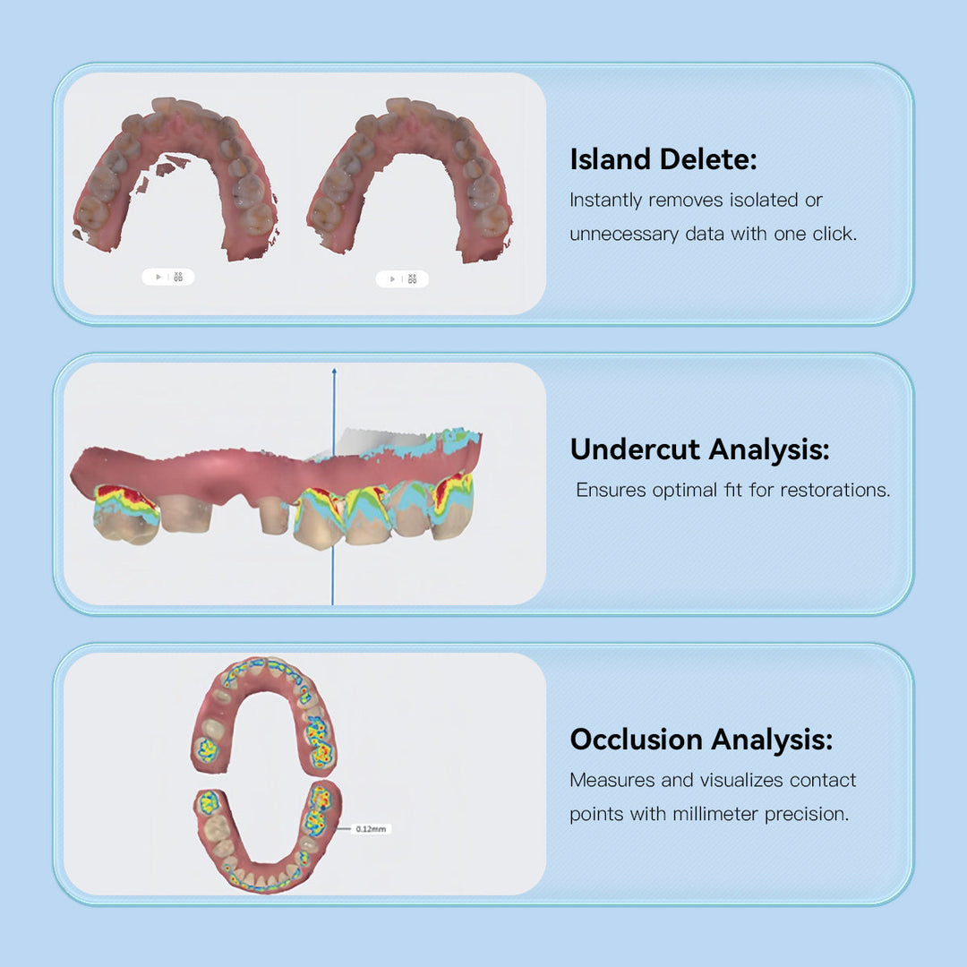 Dental 3D Intraoral Scanner with Software AI Tech Real Color CAD/CAM Digital Impression USB