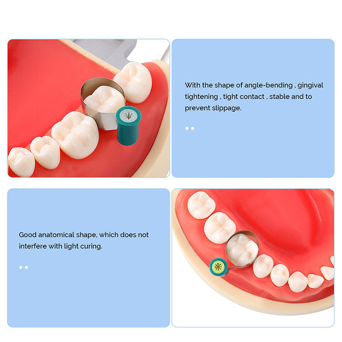 Dental Matrix Bands Stainless steel Double-Side Contoured Anatomically Shaped 0.038mm/ 0.03mm