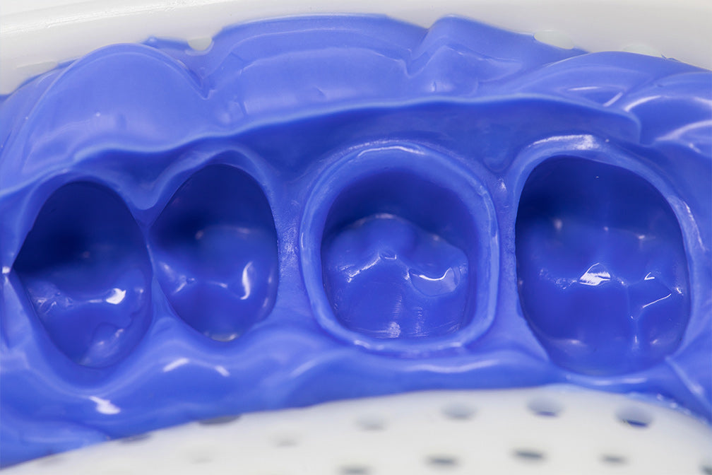 Blue dental impression material PERFIT Heavy Body-Dispenser Mix shown in close-up, displaying detailed molds of dental structure with precise indentations and contours for crown and bridge impressions