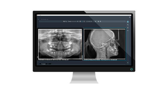 X-Mind prime 3D PAN / CBCT / CEPH