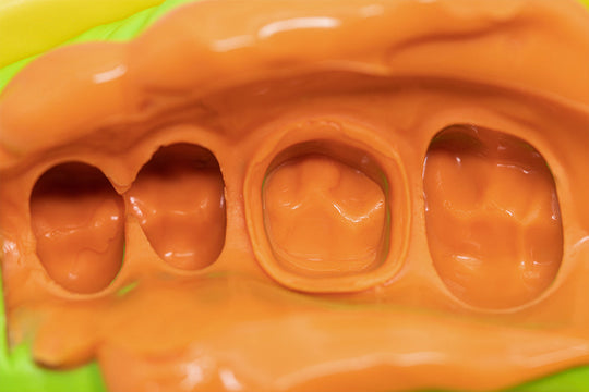 Detailed dental impression mold showing precise tooth indentations in orange silicone material PERFIT Light Body, demonstrating high-definition capture capabilities for accurate dental work