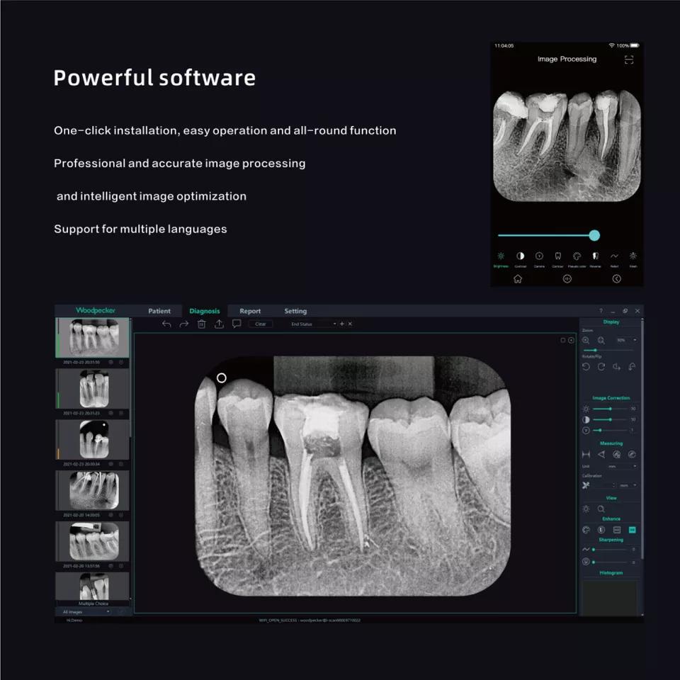 Woodpecker Dental Digital X-ray Imaging Plate Scanner i-Scan Wireless W/Screen