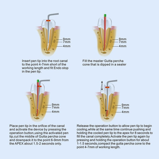 Dental Cordless Gutta Percha Obturation System Endo Heated Pen