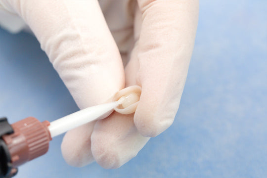 Gloved hands demonstrating application technique of TopCEM Dual Cure Resin Cement using precision syringe tip for dental restoration procedures, shown against blue medical background TopCEM Dual Cure Resin Cement