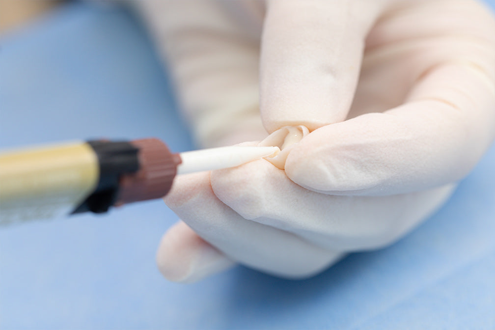 Dental professional applying TopCEM-RMGI Resin Modified Glass Ionomer Cement-Luting with precision syringe applicator, demonstrating proper dental cementation technique in clinical setting