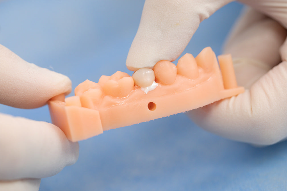 Close-up demonstration of TopCEM-RMGI Resin Modified Glass Ionomer Cement-Luting application on dental prosthetic model, showing precise cement placement on artificial tooth bridge against blue background