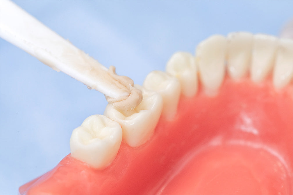 Application demonstration of Glass Ionomer Cement Luting II on dental model showing precise cementation technique with white applicator dispensing material onto prosthetic tooth surface against pink gum tissue background