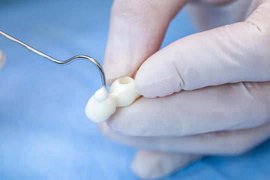 Dental professional applying Glass Ionomer Cement Luting I to tooth restoration with precision dental tool, demonstrating proper technique for ceramic crown bonding