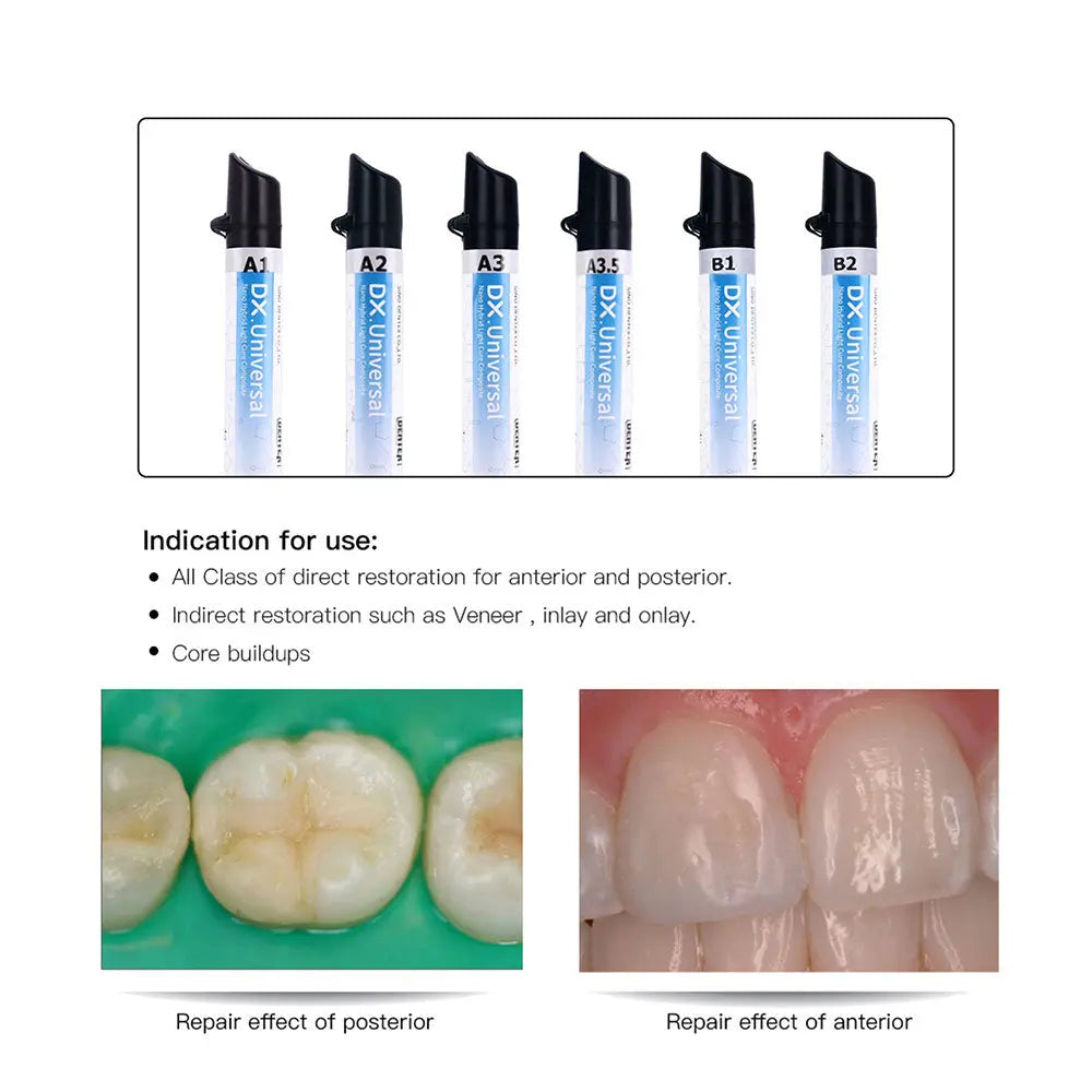 Dental Universal Nano Hybrid Light Cure Composite Resin syringes in various shades, with product indications and before-after dental repair images showing effectiveness for posterior and anterior teeth restoration.