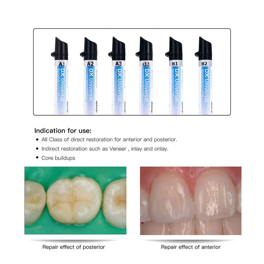 Dental Universal Nano Hybrid Light Cure Composite Resin syringes in various shades, with product indications and before-after dental repair images showing effectiveness for posterior and anterior teeth restoration.