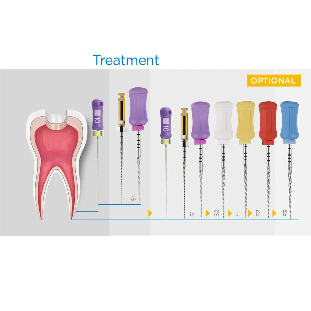 Dental Endodontics NiTi Hand Use Super Rotary File 25mm SX-F3 6pcs/Box illustrated with diagram showing tooth cross-section and various colorful endodontic files for root canal treatment, including SX, S1, S2, F1, F2, and F3 sizes.