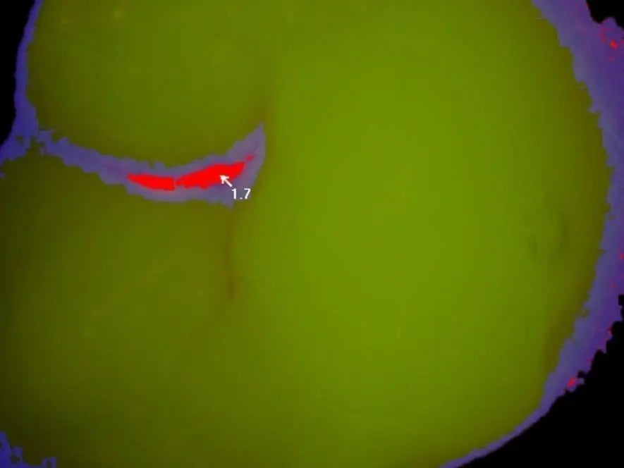 CamX Spectra Caries Detection Aid image showing tooth surface with green healthy enamel and red area indicating potential decay, with numerical score 1.7 visible, demonstrating the device's fluorescence-based caries detection capability.