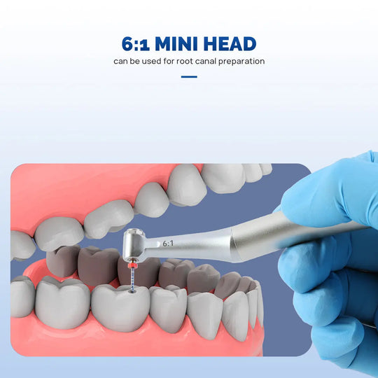 Dental 6:1 Reduction Endo Handpiece Contra Angle Mini Head Push Button shown in use for root canal preparation, illustrating its compact size and precision in a dental diagram with gloved hands holding the device