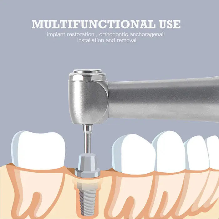 Dental Electric Wireless Torque Driver shown installing dental implant, demonstrating multifunctional use for implant restoration, orthodontic anchorage, and nail installation/removal. Precision tool for professional dental procedures.