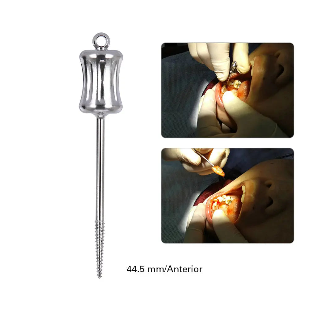 Dental Mini Manual Extractor Apical Root Fragments Drill Long 44.5mm, stainless steel instrument with tapered self-tapping threads and safety eyelet, shown alongside dental procedure images demonstrating its use in extracting root fragments safely and effectively