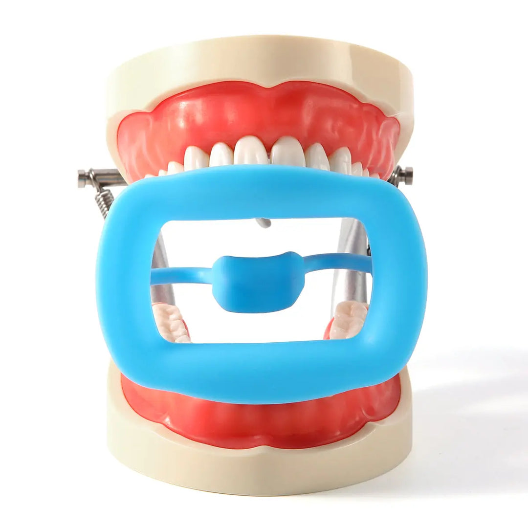 Dental Soft Mouth Opener Orthodontic 3D Intraoral Lip Cheek Retractor shown on dental model. Blue silicone device holds mouth open, revealing teeth and gums. Demonstrates product's function for dental examinations and procedures.