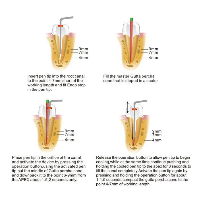 Dental Wireless Gutta Percha Obturation Endo Heated Pen illustrated usage steps: inserting pen into root canal, filling with Gutta percha, placing pen in canal orifice, and releasing button to begin cooling. Diagram shows measurements and process for dental procedure.