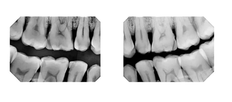 Intraoral Sensors MediFocal