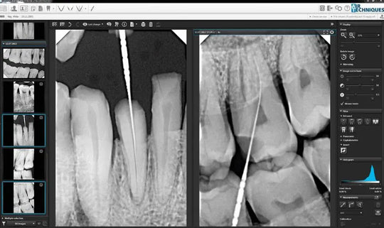 Intraoral Sensors MediFocal