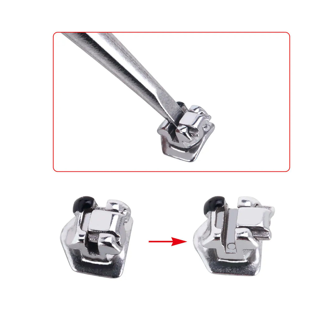 Dental Metal Self-Ligating Brackets MBT .022 closeup showing bracket mechanism and installation tool. Image displays open and closed positions of self-ligating bracket, demonstrating low-friction design for efficient orthodontic treatment.