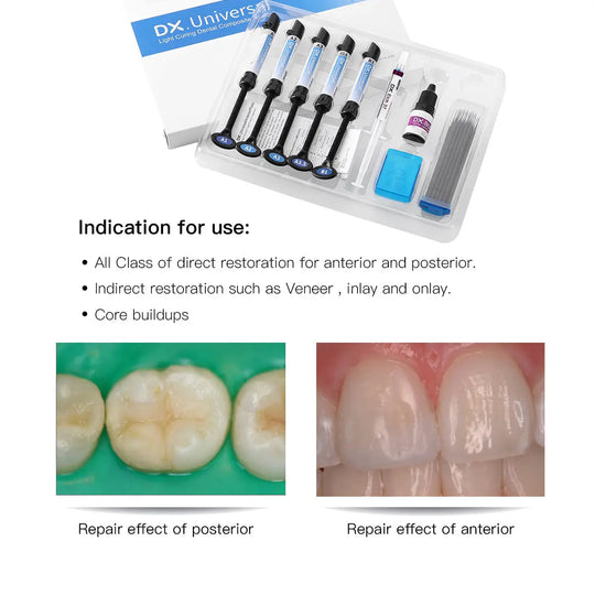 Light Cure Hybrid Dental Resin Composite 5 Syringe Kit A1 A2 A3 A3.5 B1 MediFocal