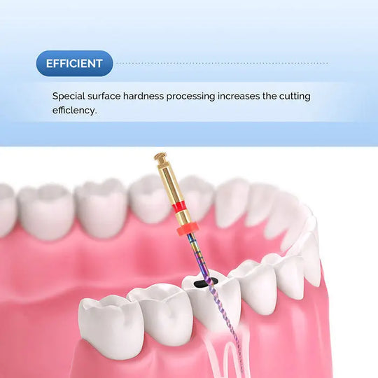 Dental Engine Rotary Files Endo NiTi Thermal Activation Rainbow Files demonstrated on a dental model, showcasing efficient cutting through special surface hardness processing for enhanced endodontic procedures