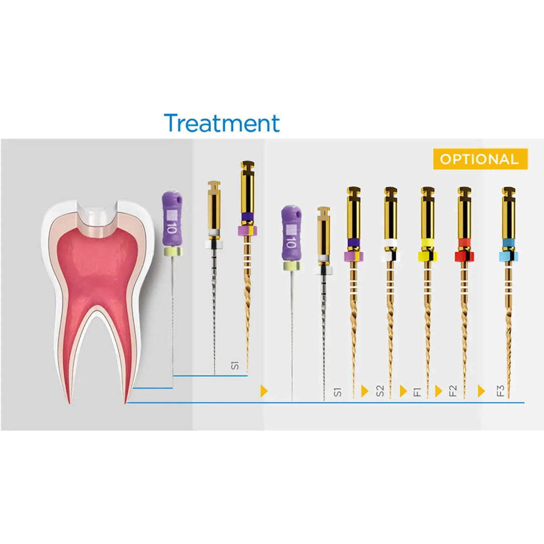 Dental NiTi Rotary Engine Files 25mm Assorted SX-F3 Gold 6pcs/Pk: Diagram showing tooth cross-section and sequence of rotary files for root canal treatment, including SX, S1, S2, F1, F2, and F3 files with color-coded handles and varying sizes.