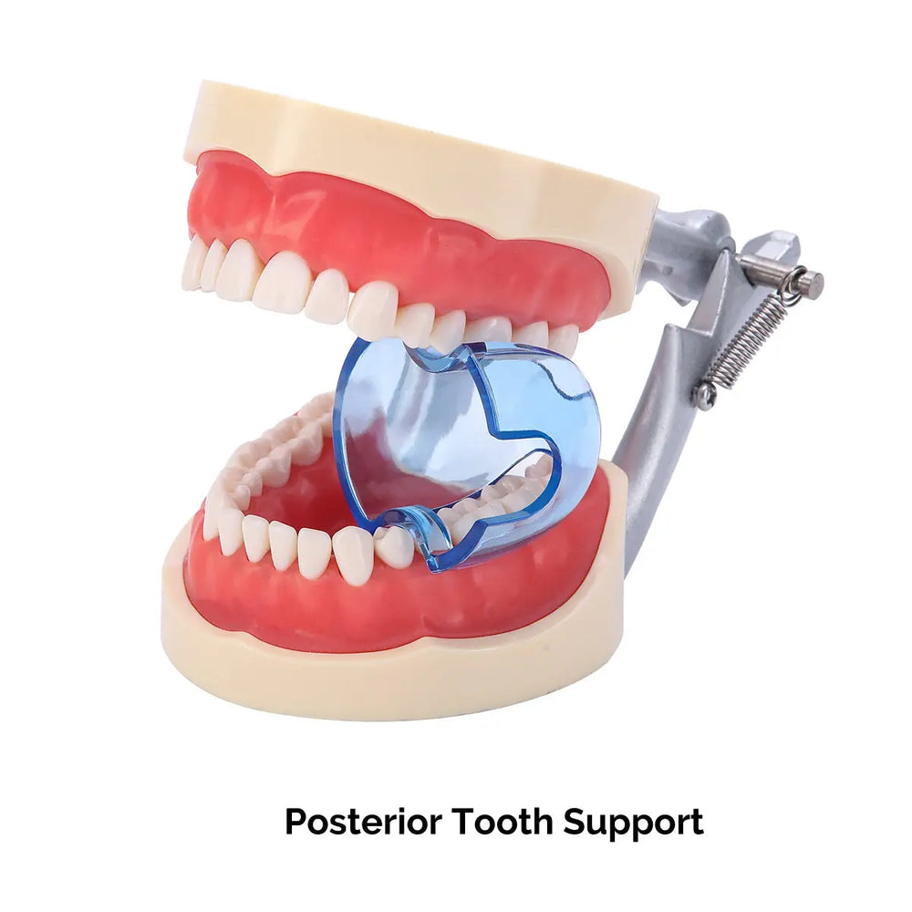 Dental Orthodontic Mouth Opener Lip Cheek Retractor Clear Plastic Anterior/Posterior Tooth Support showing a model of human teeth with red gums and a blue posterior tooth support device, demonstrating dental tools for optimal oral cavity visibility and dental procedures