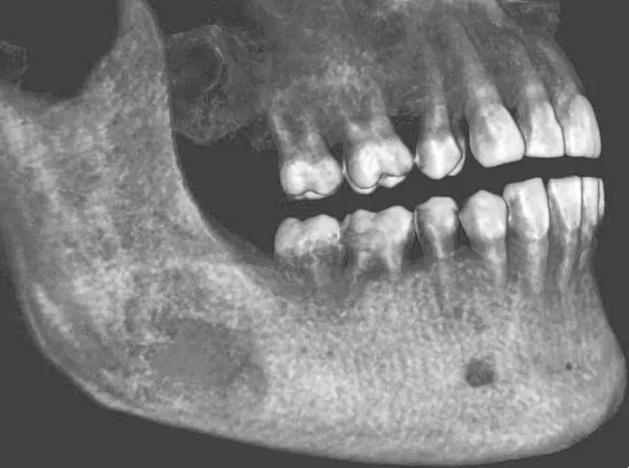 ProVecta 3D Prime MediFocal