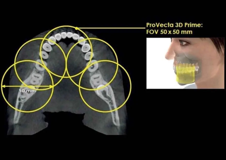 ProVecta 3D Prime MediFocal