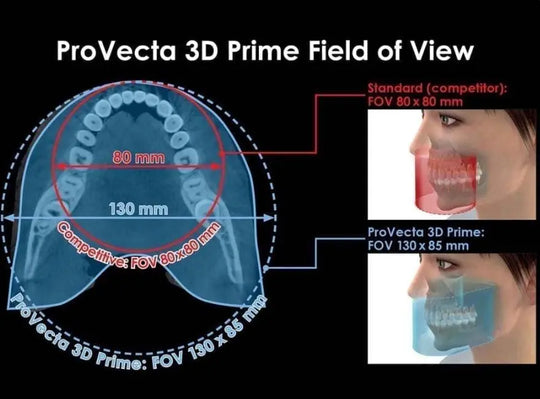 ProVecta 3D Prime MediFocal