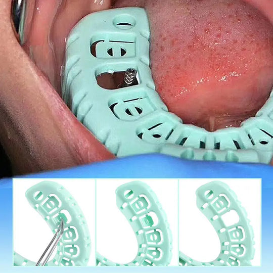 Dental Impression Trays Full Mouth for Teeth Mold Tray S M L Green 6pcs/Set shown in use and close-up. Green tray with perforations placed in mouth, lower image displays three sizes of trays with measurement markings.