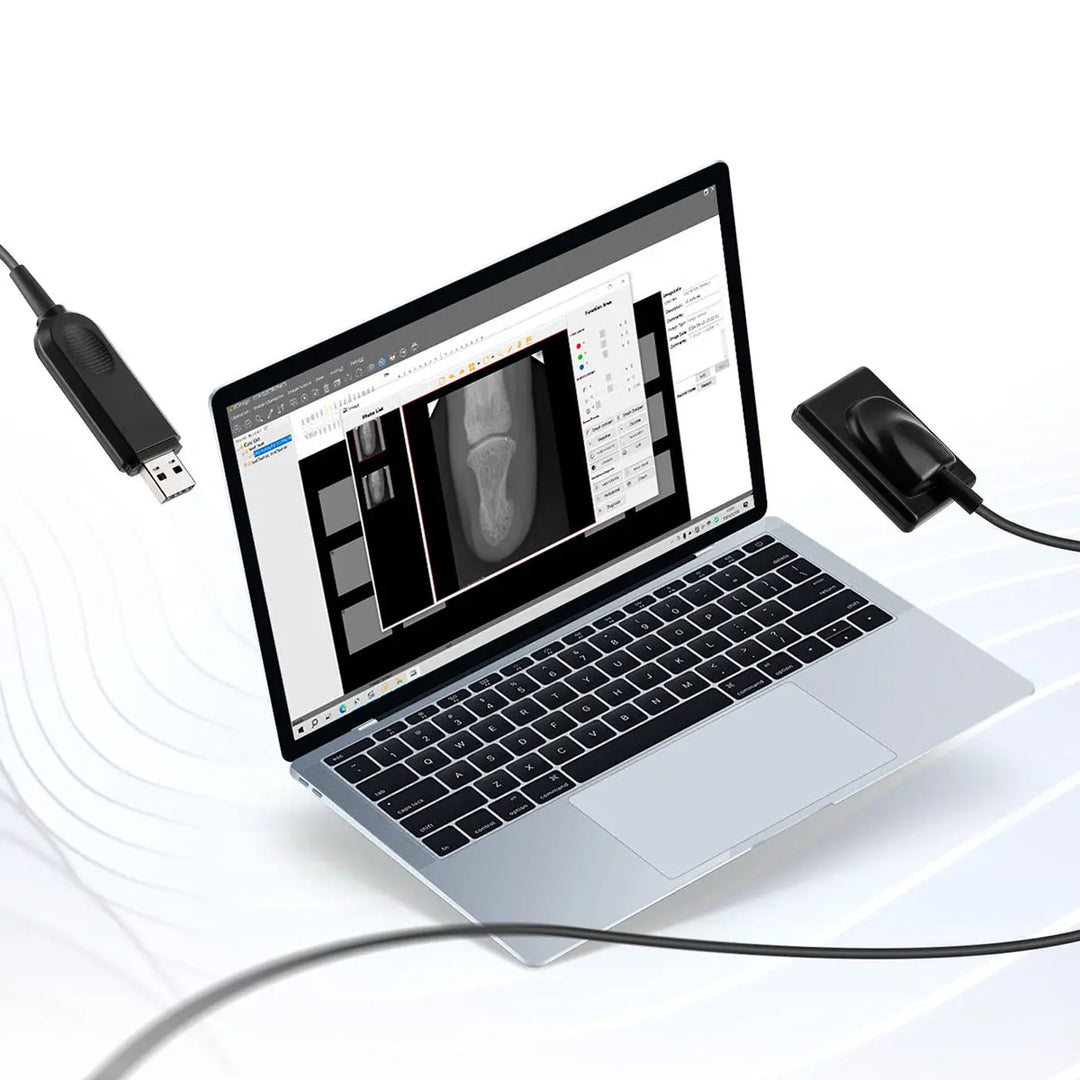 Dental Sensor X-Ray Digital Sensor Intraoral Digital System HD Image Size1/Size2 displayed on laptop screen with USB connection to sensor device, showing high-resolution dental X-ray image and software interface