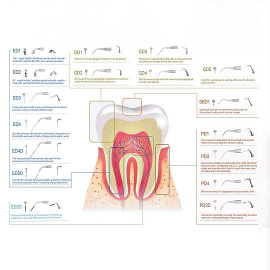 Ultrasonic Scaler Cavity Preparation Tips SBD1 MediFocal