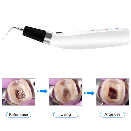 Dental Ultrasonic Activator Irrigator with 6 Tips Cordless Ultrasonic Operation 300° Rotation