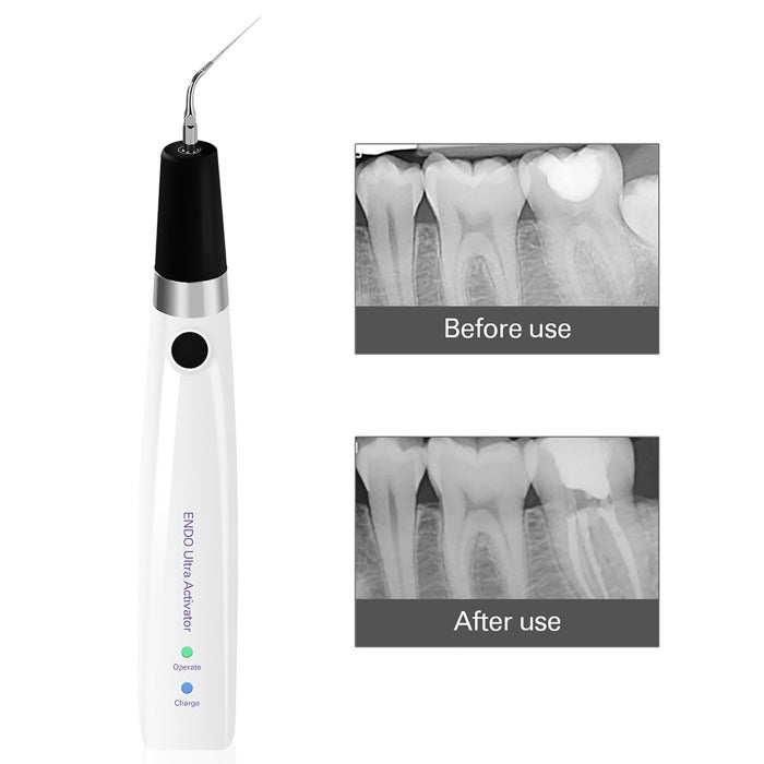 Dental Ultrasonic Activator Irrigator with 6 Tips Cordless Ultrasonic Operation 300° Rotation