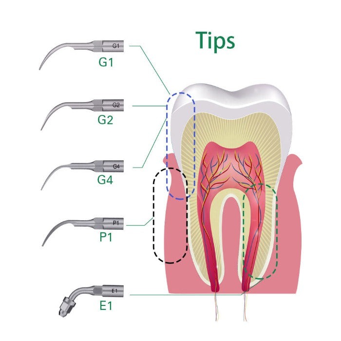 [1151501000] Dental Ultrasonic Scaler Wireless Control Detachable LED Handpiece and Handle Line