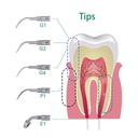 Dental Ultrasonic Scaler Wireless Control Detachable LED Handpiece and Handle Line