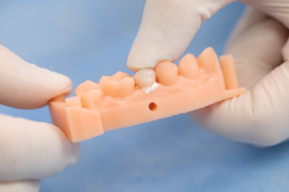 [topcem-rmgi-resin-modified-glass-ionomer-cement-luting] TopCEM-RMGI ซีเมนต์ยึดติดชนิดดัดแปลงเรซินกลาสไอโอโนเมอร์