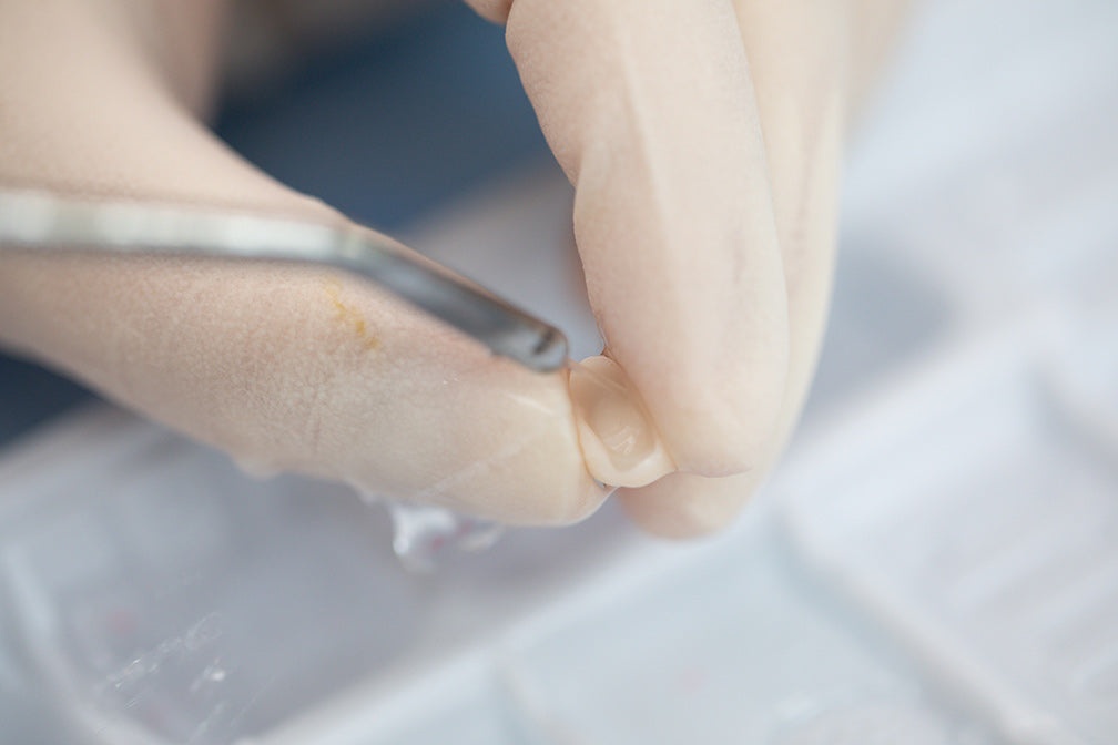 [hf-etchant-hydrofluoric-acid-etching-gel] HF-Etchant Hydrofluoric Acid Etching Gel