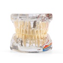Dental Oral Typodont Model Implant Pathological Removable Teach Demo Transparent