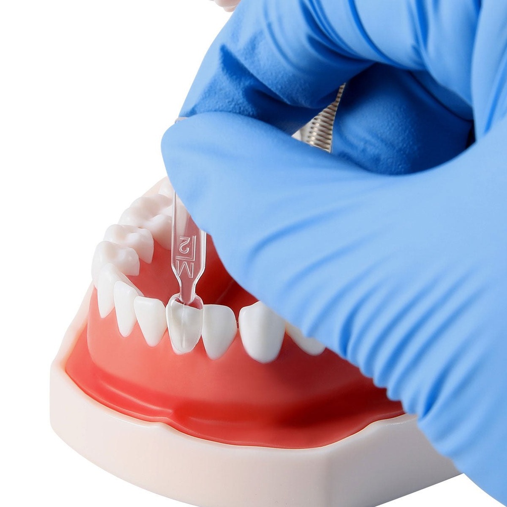 Dental Veneer Mould Kit Light Cure Composite Resin Teeth Fast Whitening Tools Autoclave 32pcs/Kit (1 Kit)