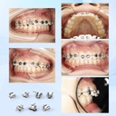 Dental Metal Self-Ligating Brackets Multiple Hooks Roth/MBT .022 28pcs/Box